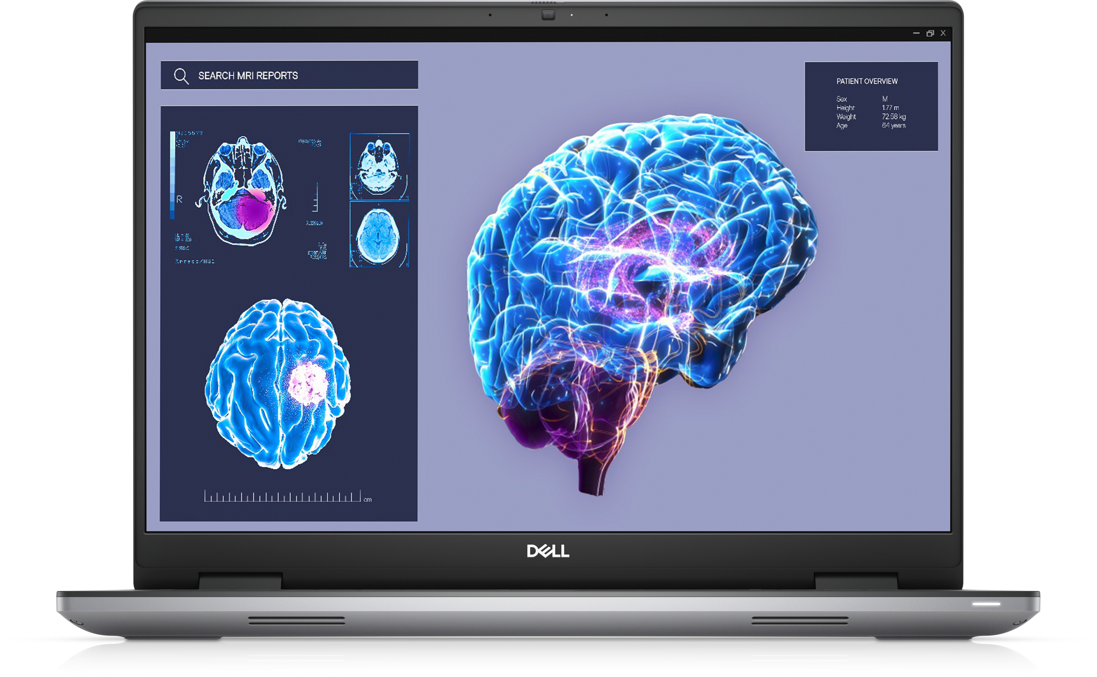 DELL Precision 7680 i7-13850HX Station de travail mobile 40,6 cm (16") Full HD+ Intel® Core™ i7 32 Go DDR5-SDRAM 1000 Go SSD NVIDIA RTX 2000 Wi-Fi 6E (802.11ax) Windows 11 Pro Gris DELL Precision 7680 i7-13850HX Station de travail mobile 40,6 cm (16") Full HD+ Intel® Core™ i7 32 Go DDR5-SDRAM 1000 Go SSD NVIDIA RTX 2000 Wi-Fi 6E (802.11ax) Windows 11 Pro Gris